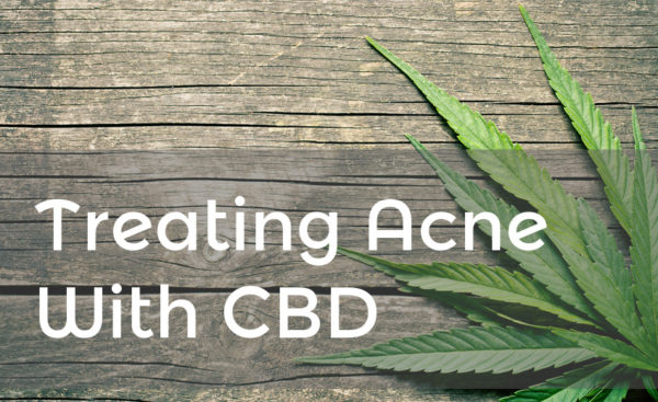 Treating acne with CBD banner.